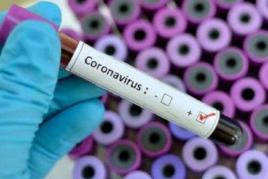 Covid-19 au Sénégal : Deux nouveaux cas signalés à Touba