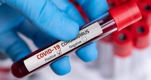 Covid-19 : Thiès enregistre 25 contaminations et un décès