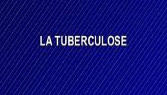 Santé : Ce 24 mars, le ministre de la Santé Diouf Sarr veut mobiliser les leaders à Touba pour mettre fin à la tuberculose