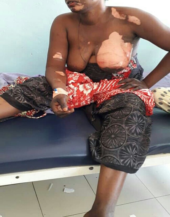 Kaolack-Nioro : Une femme ébouillante sa co-épouse pour une histoire de nuisance sonore