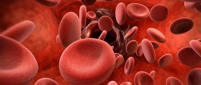 Journée mondiale Drépanocytose : 200 000 nouveaux cas par an en Afrique Subsaharienne