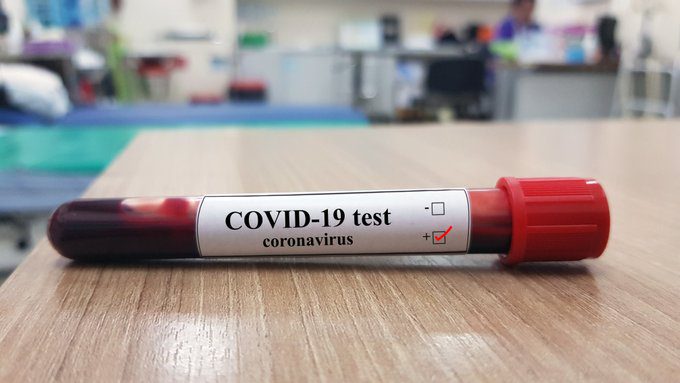 Covid19- 132 cas positifs et 70 guérisons ce 11 juillet