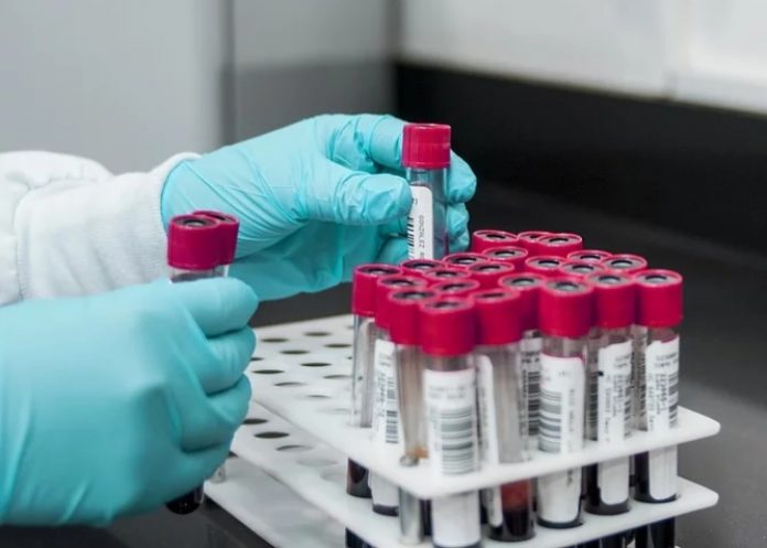 Maladie à coronavirus : Toujours pas de vaccin selon l’Oms